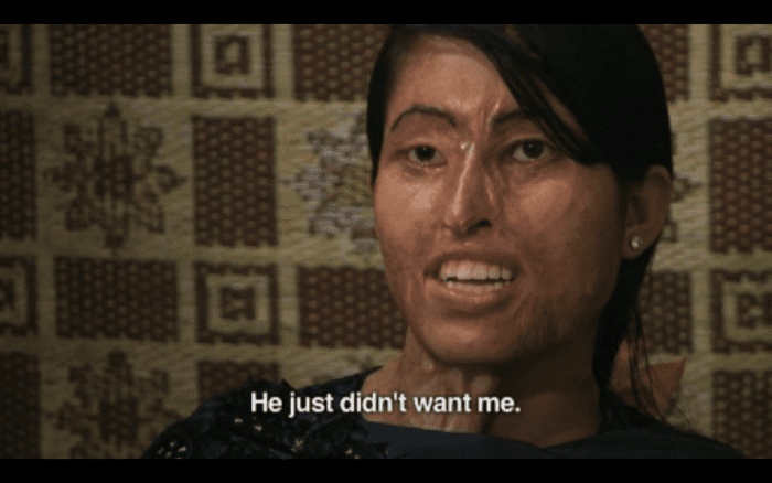 This woman's husband threw acid on her while she slept, simply because he didn't want her anymore.