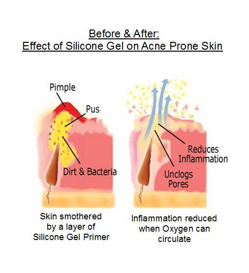 Best Face Primer for Oily Skin Mattify Ultra Powder Silicone Free