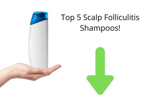 Folliculitis Scalp Treatment - How To Treat Folliculitis Bumps On Scalp ...