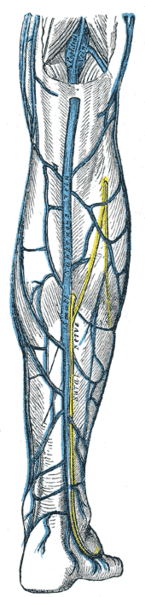 The small saphenous vein, on the lower back calf of the leg is also commonly treated with Endovenous Laser treatment.