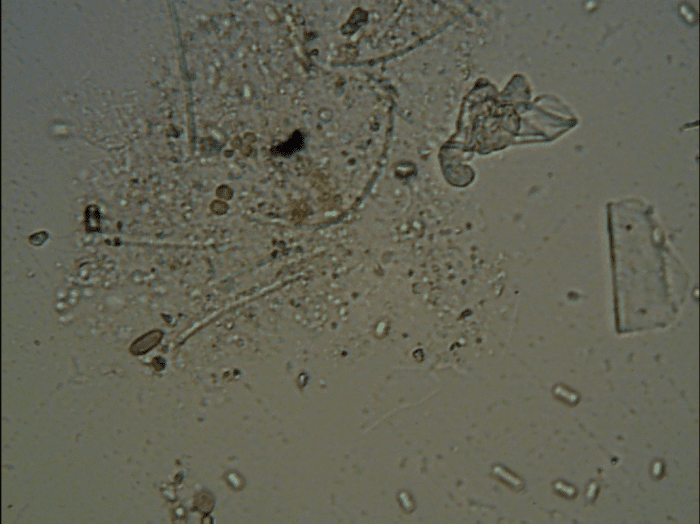Collection of organic matter, primarily food for micro-organisms, some bacteria and other single celled organisms can be seen.