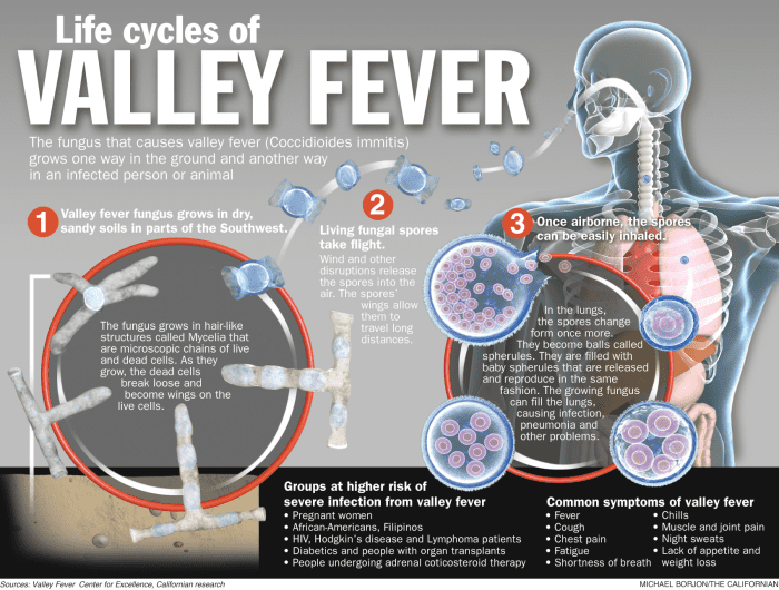 Valley Fever, Fatigue and Joint Pain Symptoms & Treatment in the