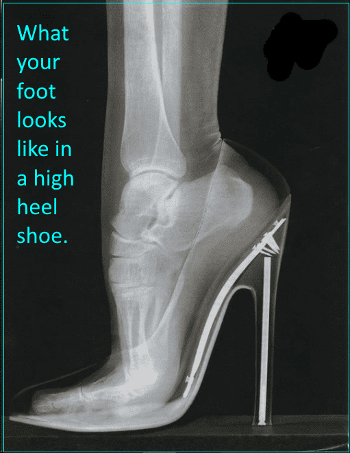 Before xrays were outlawed for the possible harm they could do to the human foot, it was standard procedure to xray the shoe within the foot to see how it fitted. Today you can trace the shape of your foot on paper, then trace the shoe shop to check.