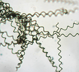spiral spirulina filaments