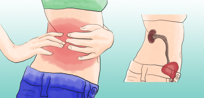 The kidneys are located between the ribs and the hips so if there is a kidney problem pain can be felt along the sides, in the upper abdomen, or mid-back.