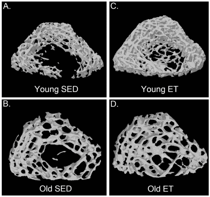 Cross sections of bone belonging to old and young sedentary vs exercise trained individuals