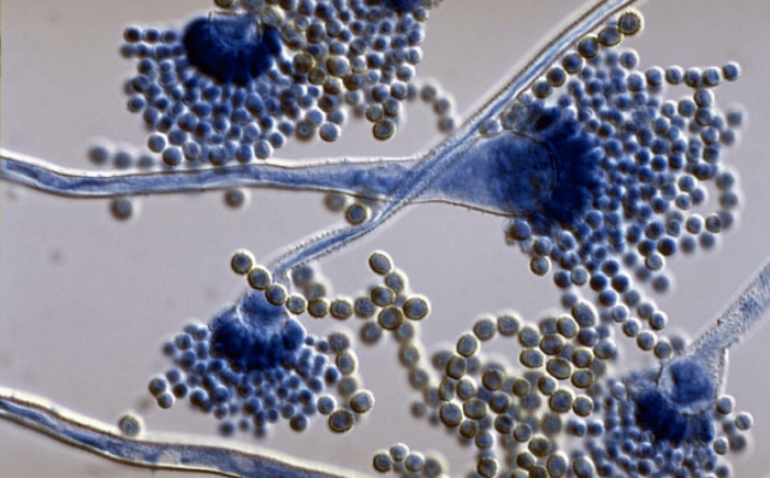 Fungal infections include athlete's foot and yeast infections. A weak immune system can generate a severe fungal infection.