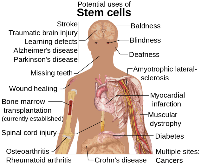 Potential uses of stem cells in the repair of body damage