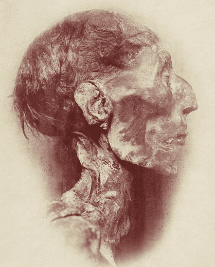 This is a photograph of the mummy of Ramses II, one of Ancient Egypt's greatest pharaohs. In order to take this picture, the bandages wrapping the mummy were removed, which unfortunately exposed the mummy to the elements and damaged it.