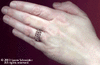 Picture 2 of 2: The micromail ring, which is very comfortable to wear since it flexes with your every move.