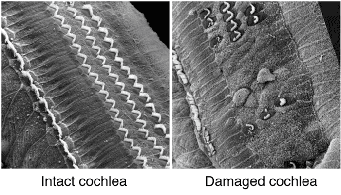 Your cochlea has tiny hairs that look like the image on the left when working well. After they get damaged they begin to look like the image on the right. They become broken or bent and can no longer detect sound as well, if at all.