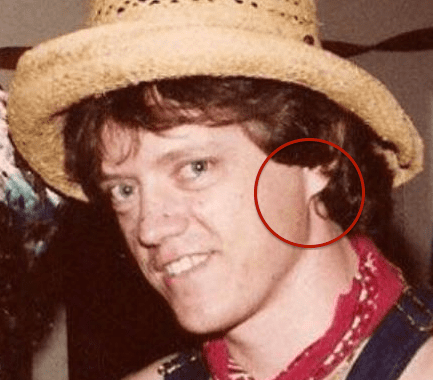 Clinton's earlobe is entirely attached. It is important to note that this is not a dominant trait; most earlobes are unattached.