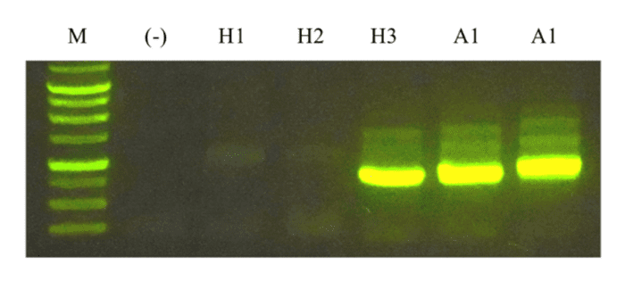 Primers were designed based on the ORF sequence (A1) from a metagenome fragment to identify its possible origin (H1, H2, H3).