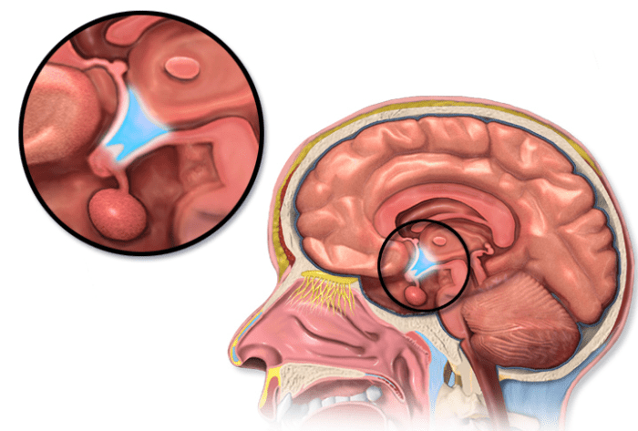 The main way in which leptin reduces appetite is believed to be via its effect on the hypothalamus in the brain (the circled blue area in the illustration).