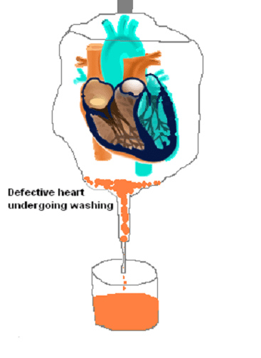 Once this heart is washed, new stem cells can be coated on the skeleton to regenerate heart tissue.
