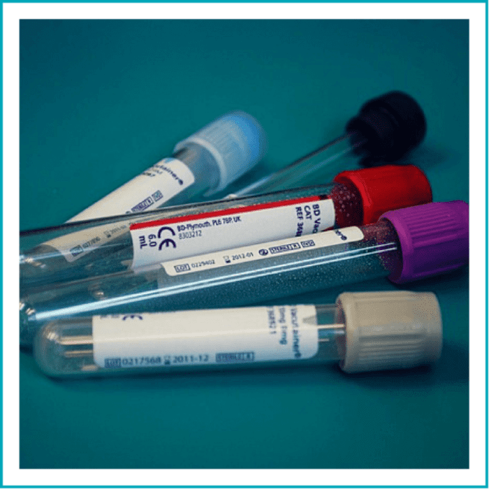 Blood Sample Collection (Pathology) Role of Phlebotomy. - HubPages