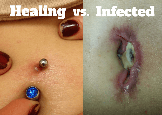 Healing belly button piercing vs infected