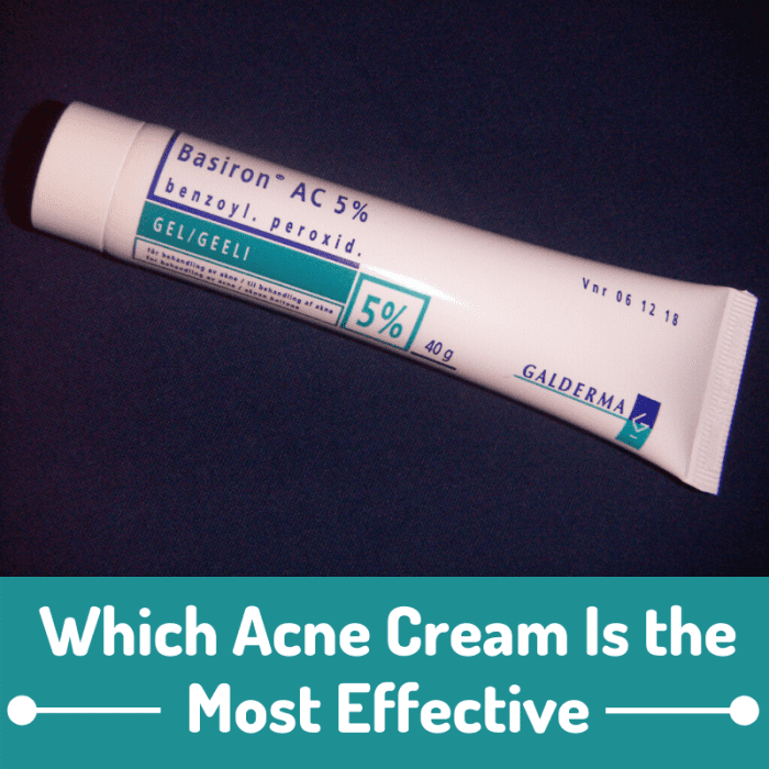 what-s-the-best-pimple-cream-2-effective-ingredients-that-zap-zits