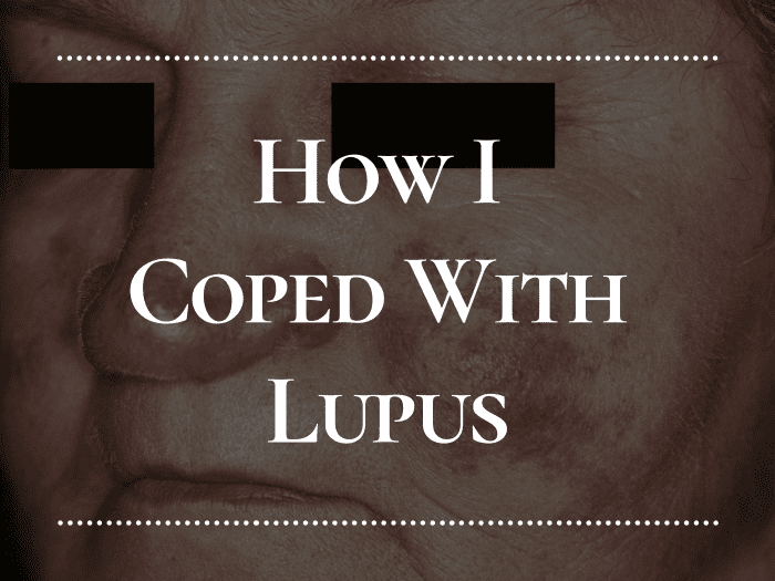 My experience with lupus: when I first got it, how it affected me, how I treated it, and my life today.