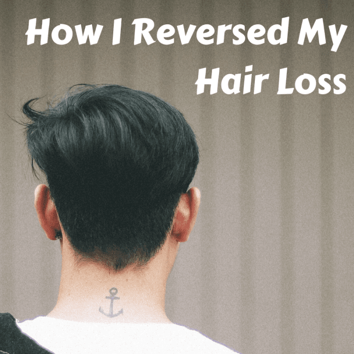 I started losing my hair at a young age. Luckily, with some research, I was able to pinpoint the causes of my problem and reverse it with some significant lifestyle changes.