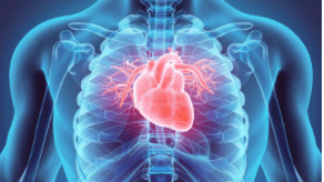 Wherever there is inflammation in the body, cholesterol is sure to follow so that it can aid in the repair of the damage.