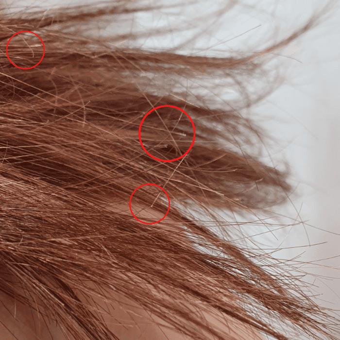 Here you can see how damaged my hair is. You can see how I have split ends and these breaking white points where my hair just breaks of.