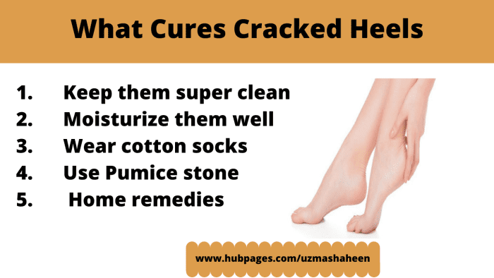 How to Fix Cracked Heels Permanently and Get Soft Feet at Home - HubPages