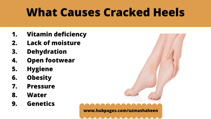 How to Fix Cracked Heels Permanently and Get Soft Feet at Home - HubPages