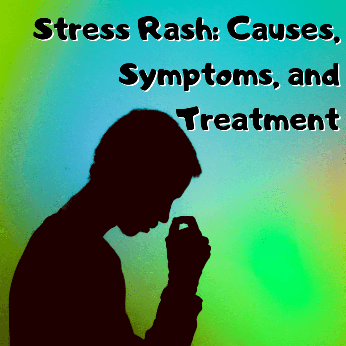 Stress Rash: Causes, Symptoms, And Treatment - YouMeMindBody