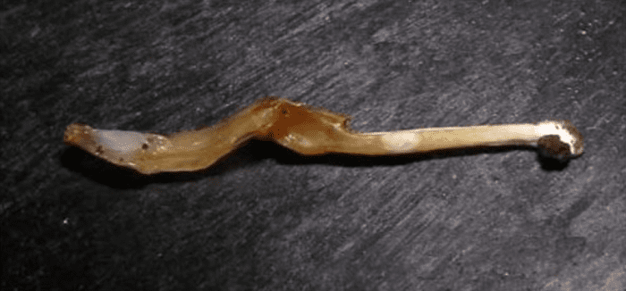 The spermatophore of a Heterometrus phipsoni after insemination, length ca. 10.5 millimeters (laboratory photo). Heterometrus is a genus of scorpion usually referred to as giant forest scorpions. They primarily live in the tropics of Southeast Asia.