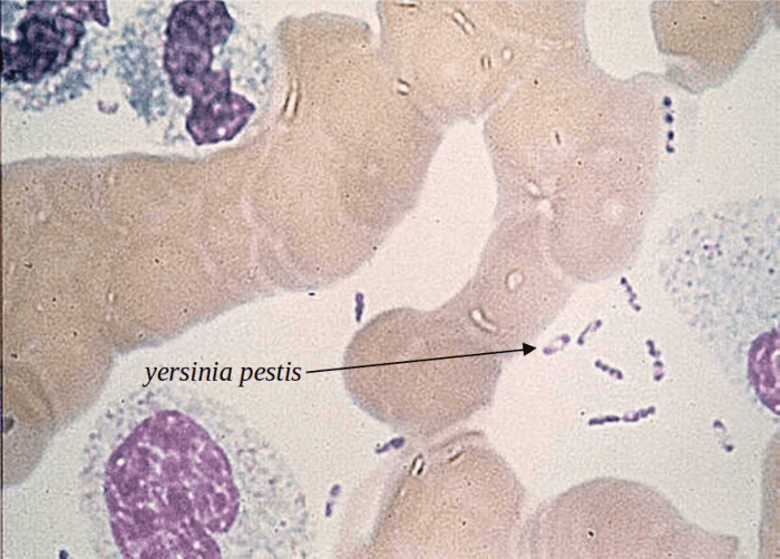 The bacteria causing bubonic plague under microscope, discovered 500+ years after black death