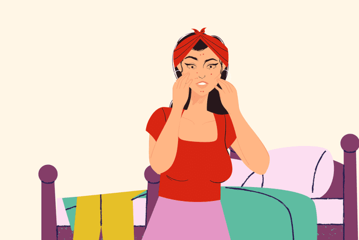 acne-treatments-at-home