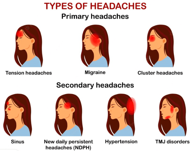 best-migraine-relief-tips-to-use-at-home-hubpages