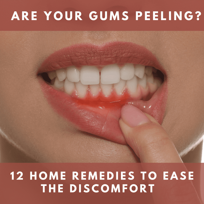 are-your-gums-peeling-how-to-fix-them-before-it-s-too-late-youmemindbody