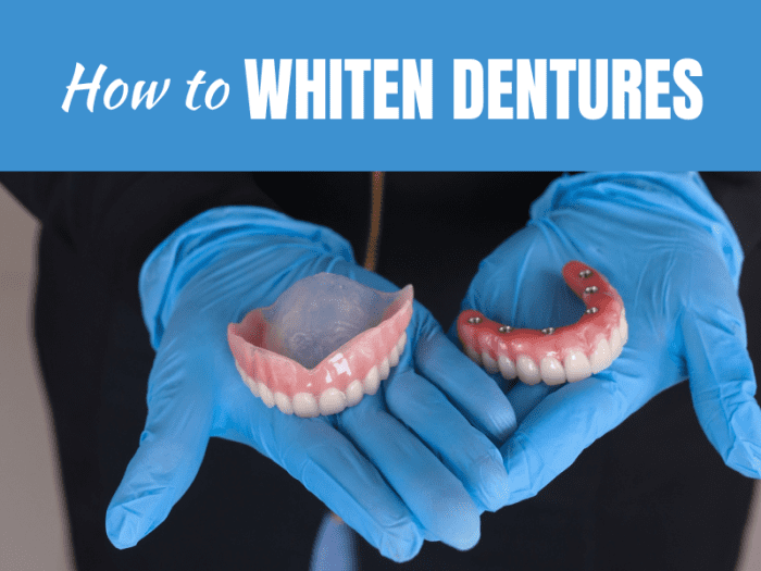 How to Whiten Your Dentures: A Step-by-Step Guide - YouMeMindBody