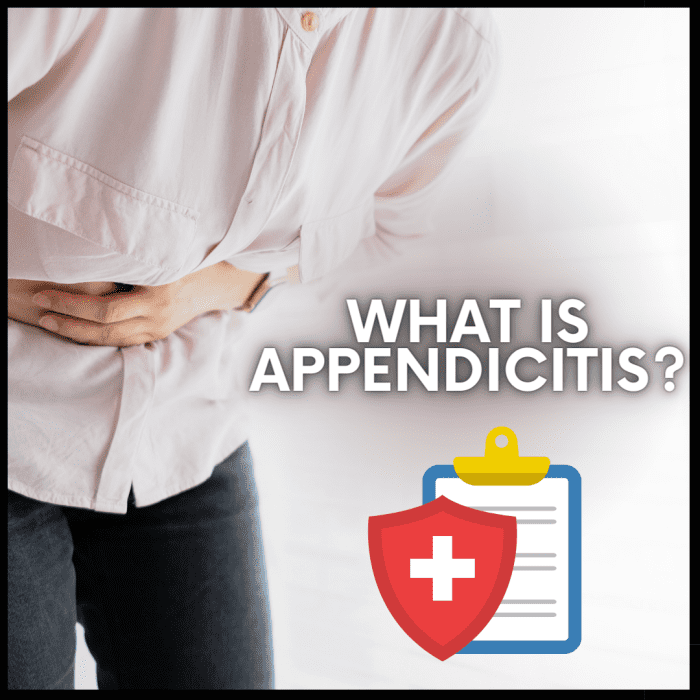 Appendicitis Causes, Symptoms, Diagnosis, and Treatments HealthProAdvice