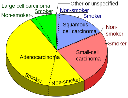 Pie chart showing incidences of NSCLCs as compared to SCLCs shown at right, with fractions of smokers versus nonsmokers shown for each type, Wikipedia.com