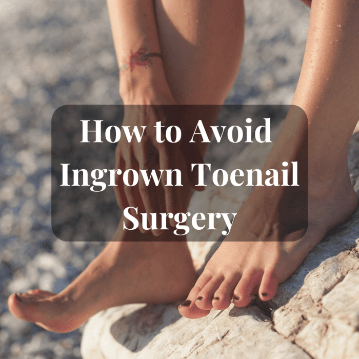 Some ingrown toenail home remedies work. Others do not. It's best to see a Podiatrist early so that you can avoid surgery.