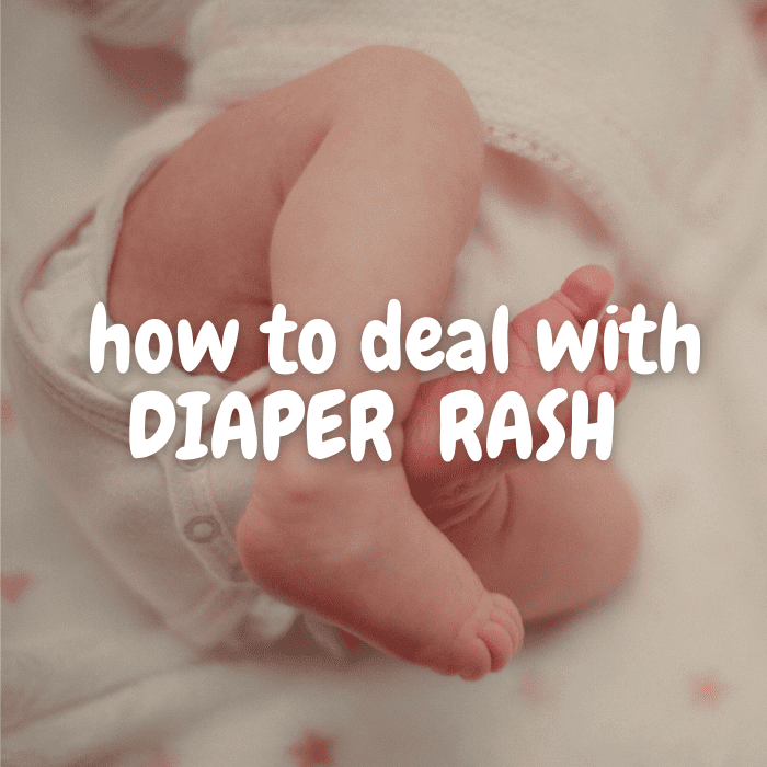 Most times diaper rash is uncomfortable for your baby but doesn't represent a risk to her health. However, it can be a sign of more serious conditions which parents should know about