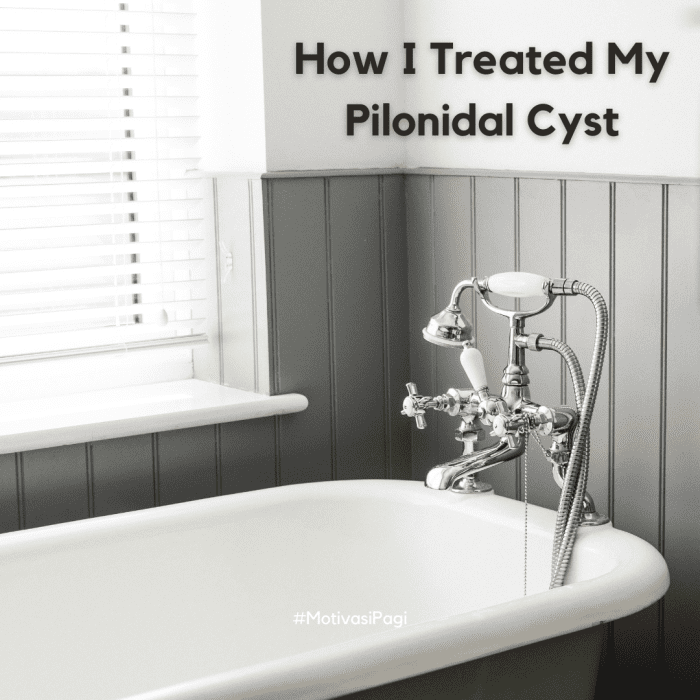 definitive-guide-to-pilonidal-cysts-my-experience-patient-s-lounge