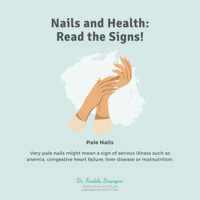 What do Your Nails say About Your Health? HubPages