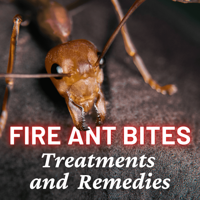 How To Treat Fire Ant Bites: Treatment Tips And Home Remedies ...