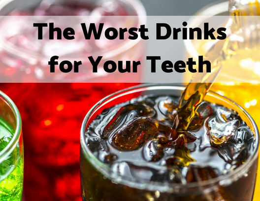 Top 10 Worst Drinks for Your Teeth - YouMeMindBody