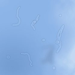 Floaters come in all shapes and sizes. They can be clear, as seen in the picture, or they can be grey or even black.