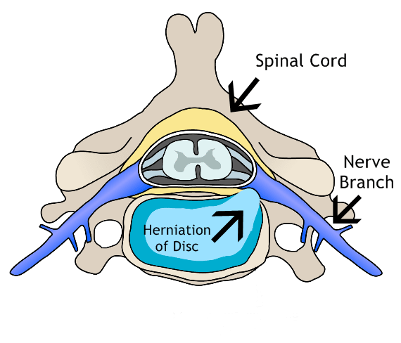 Bird's eye view of the anatomy of a vertebra