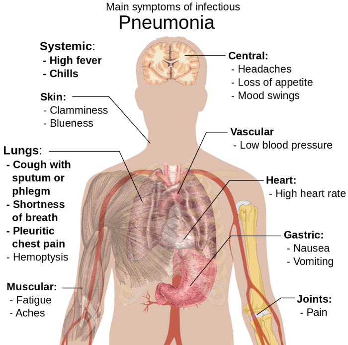 Possible symptoms of pneumonia