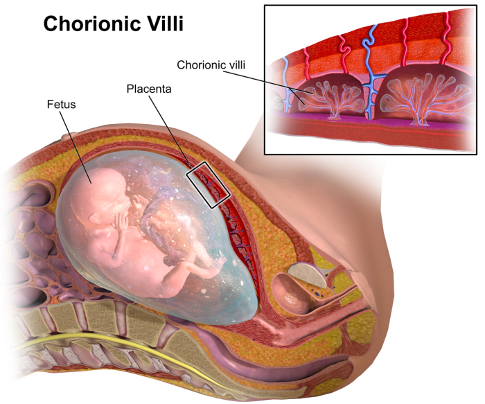 A sampling of the chorionic villus, part of the baby's placenta, allows for testing of the fetal chromosomes and more detailed genetic testing.