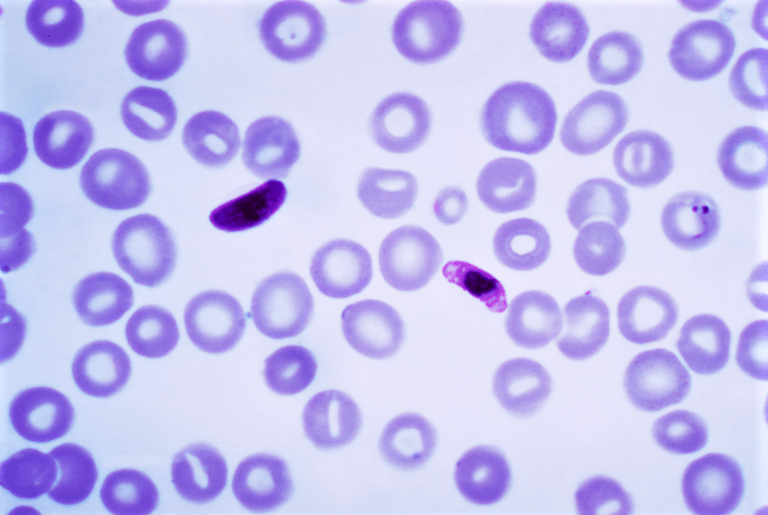 Stages in the life cycle of Plasmodium falciparum (stained slide); the round cells are red blood cells
