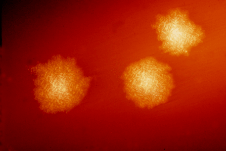 C. difficile colonies can sometimes run rampant after a course of antibiotics.