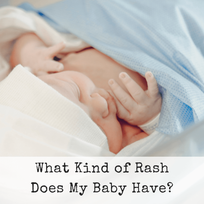 Discovering your infant has a rash can cause panic. What is it? Do you need to call a doctor? Here are four of the most common rashes.